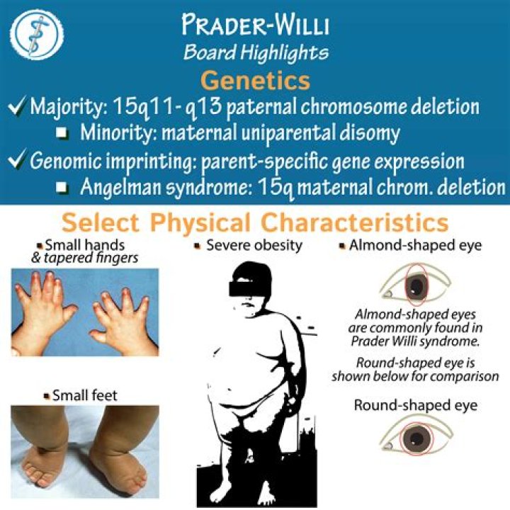 Can prader willi syndrome be mild?