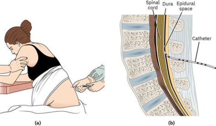 Why is intrathecal chemotherapy used?